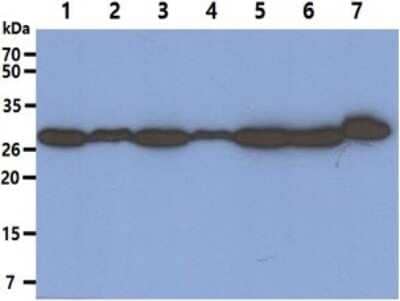 Western Blot: PA28 Activator alpha Subunit/PSME1 Antibody (12H3) [NBP2-59434] - Lane 1: HeLa cell lysates, Lane 2: LnCaP cell lysates, Lane 3: A549 cell lysates, Lane 4: 293T cell lysates, Lane 5: Jurkat cell lysates, Lane 6: Raji cell lysates, Lane 7: A431 cell lysates