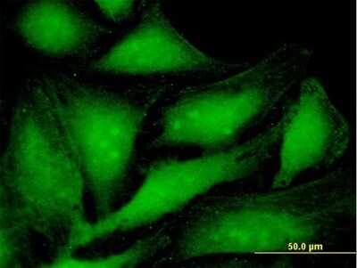 Immunocytochemistry/Immunofluorescence: PA28 Activator alpha Subunit/PSME1 Antibody [H00005720-B01P] - Analysis of purified antibody to PSME1 on HeLa cell. (antibody concentration 10 ug/ml)