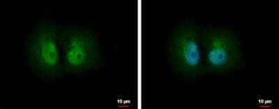 Immunocytochemistry/Immunofluorescence: PA28 Activator alpha Subunit/PSME1 Antibody [NBP2-19991] - H1299 cells were fixed in 4% paraformaldehyde at RT for 15 min. Green: PSME1 protein stained by PSME1 antibody  diluted at 1:500. Blue: Hoechst 33342 staining. Scale bar = 10 um.