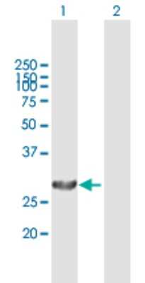 Western Blot: PA28 Activator alpha Subunit/PSME1 Antibody [H00005720-B02P] - Analysis of PSME1 expression in transfected 293T cell line by PSME1 polyclonal antibody.  Lane 1: PSME1 transfected lysate(27.39 KDa). Lane 2: Non-transfected lysate.