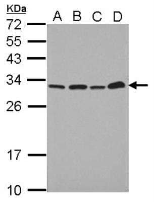 Western Blot: PA28 Activator alpha Subunit/PSME1 Antibody [NBP2-19991] -  Sample (30 ug of whole cell lysate) A: A549 B: H1299 C: HCT116 D: MCF-7 12% SDS PAGE gel, diluted at 1:10000.