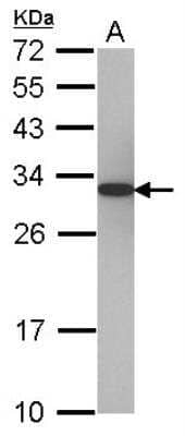 Western Blot: PA28 Activator alpha Subunit/PSME1 Antibody [NBP2-19992] - Sample (30 ug of whole cell lysate) A: 293T 12% SDS PAGE gel, diluted at 1:5000.