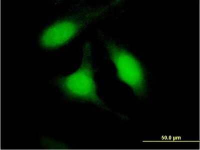 Immunocytochemistry/Immunofluorescence: PA28 Activator beta Subunit/PSME2 Antibody [H00005721-B01P] - Analysis of purified antibody to PSME2 on HeLa cell. (antibody concentration 10 ug/ml)