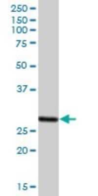 Western Blot: PA28 Activator beta Subunit/PSME2 Antibody [H00005721-B01P] - Analysis of PSME2 expression in human liver.