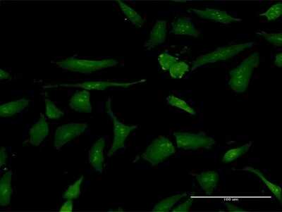 Immunocytochemistry/Immunofluorescence: PA28 Activator gamma Subunit/PSME3 Antibody [H00010197-B01P] - Analysis of purified antibody to PSME3 on HeLa cell. (antibody concentration 30 ug/ml)