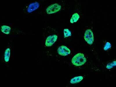 Immunocytochemistry/Immunofluorescence: PA28 Activator gamma Subunit/PSME3 Antibody [NBP3-00356] - Immunofluorescence staining of PA28 Activator gamma Subunit/PSME3 in HeLa cells. Cells were fixed with 4% PFA, permeabilzed with 0.3% Triton X-100 in PBS, blocked with 10% serum, and incubated with rabbit anti-human PA28 Activator gamma Subunit/PSME3 polyclonal antibody (dilution ratio 1:1000) at 4C overnight. Then cells were stained with the Alexa Fluor(R)488-conjugated Goat Anti-rabbit IgG Secondary antibody (green) and counterstained with DAPI (blue). Positive staining was localized to nucleus.