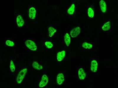 Immunocytochemistry/Immunofluorescence: PA28 Activator gamma Subunit/PSME3 Antibody [NBP3-00357] - Immunofluorescence staining of PA28 Activator gamma Subunit/PSME3 in HeLa cells. Cells were fixed with 4% PFA, permeabilzed with 0.1% Triton X-100 in PBS, blocked with 10% serum, and incubated with rabbit anti-human PA28 Activator gamma Subunit/PSME3 polyclonal antibody (dilution ratio 1:300) at 4C overnight. Then cells were stained with the Alexa Fluor$488-conjugated Goat Anti-rabbit IgG secondary antibody (green). Positive staining was localized to nucleus.