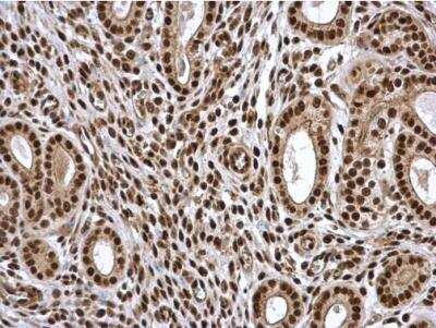 Immunohistochemistry-Paraffin: PA28 Activator gamma Subunit/PSME3 Antibody [NBP1-33498] - Mouse cervix. PSME3 antibody diluted at 1:500. Antigen Retrieval: Citrate buffer, pH 6.0, 15 min. 