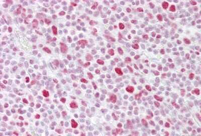 Immunohistochemistry-Paraffin: PA28 Activator gamma Subunit/PSME3 Antibody [NBP1-54587] - Human Tonsil Tissue, 4-8ug/ml.