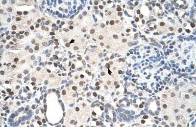 Immunohistochemistry-Paraffin: PA28 Activator gamma Subunit/PSME3 Antibody [NBP1-54587] - Human kidney Tissue, antibody concentration 4-8ug/ml. Cells with positive label: renal corpuscle cells (indicated with arrows) 400X magnification.