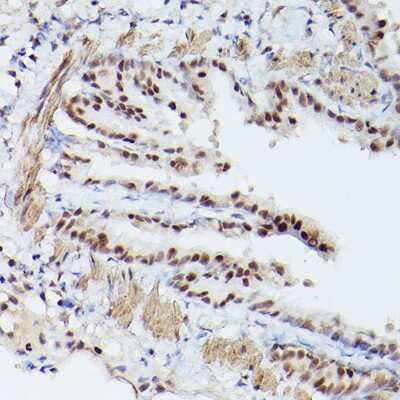 Immunohistochemistry-Paraffin: PA28 Activator gamma Subunit/PSME3 Antibody [NBP2-93183] - Immunohistochemistry of paraffin-embedded mouse lung using PA28 Activator gamma Subunit/PSME3 Rabbit pAb (NBP2-93183) at dilution of 1:100 (40x lens). Perform microwave antigen retrieval with 10 mM PBS buffer pH 7.2 before commencing with IHC staining protocol.