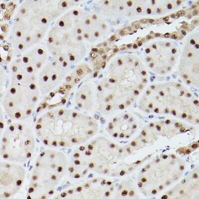 Immunohistochemistry-Paraffin: PA28 Activator gamma Subunit/PSME3 Antibody [NBP2-93183] - Immunohistochemistry of paraffin-embedded rat kidney using PA28 Activator gamma Subunit/PSME3 Rabbit pAb (NBP2-93183) at dilution of 1:100 (40x lens). Perform microwave antigen retrieval with 10 mM PBS buffer pH 7.2 before commencing with IHC staining protocol.