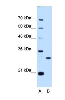 Western Blot: PA28 Activator gamma Subunit/PSME3 Antibody [NBP1-54587] - HepG2 tissue lysate at a concentration of 0.25ug/ml.
