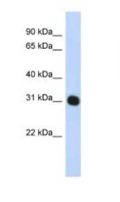 Western Blot: PA28 Activator gamma Subunit/PSME3 Antibody [NBP1-54587] - Titration: 1 ug/ml Positive Control: HepG2 cell lysate.