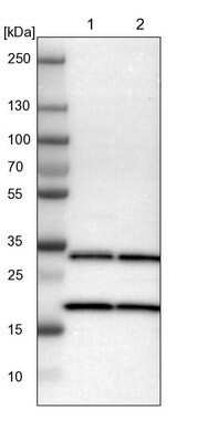 Western Blot: PA28 Activator gamma Subunit/PSME3 Antibody [NBP1-83063] - Lane 1: NIH-3T3 cell lysate (Mouse embryonic fibroblast cells). Lane 2: NBT-II cell lysate (Rat Wistar bladder tumor cells).
