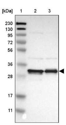 Western Blot: PA28 Activator gamma Subunit/PSME3 Antibody [NBP1-83063] - Lane 1: Marker  [kDa] 230, 130, 95, 72, 56, 36, 28, 17, 11.  Lane 2: Human cell line RT-4.  Lane 3: Human cell line U-251MG sp