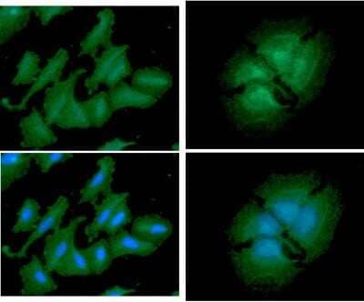 Immunocytochemistry/Immunofluorescence: PA2G4/EBP1 Antibody (5E7) [NBP2-59468] - Analysis of PA2G4 in HeLa cells line, stained with DAPI (Blue) for nucleus staining and monoclonal anti-human    PA2G4 antibody (1:100) with goat anti-mouse IgG-Alexa fluor 488 conjugate (Green). Analysis of PA2G4 in A549 cells line, stained with DAPI (Blue) for nucleus staining and monoclonal anti-human    PA2G4 antibody (1:100) with goat anti-mouse IgG-Alexa fluor 488 conjugate (Green).