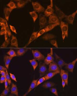 Immunocytochemistry/Immunofluorescence: PA2G4/EBP1 Antibody (9J9U5) [NBP3-16561] - Immunofluorescence analysis of NIH-3T3 cells using PA2G4/EBP1Rabbit mAb (NBP3-16561) at dilution of 1:100 (40x lens). Blue: DAPI for nuclear staining.