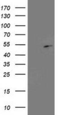 Western Blot: PA2G4/EBP1 Antibody (OTI1D3) - Azide and BSA Free [NBP2-73213] - HEK293T cells were transfected with the pCMV6-ENTRY control (Left lane) or pCMV6-ENTRY EBP1 (Right lane) cDNA for 48 hrs and lysed. Equivalent amounts of cell lysates (5 ug per lane) were separated by SDS-PAGE and immunoblotted with anti-EBP1.