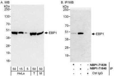 Western Blot: PA2G4/EBP1 Antibody [NBP1-71840] - Whole cell lysate from HeLa (5, 15 and 50 mcg for WB; 1 mg for IP, 20% of IP loaded), 293T (T, 50 mcg) and mouse NIH3T3 (M; 50 mcg) cells.  Affinity purified rabbit anti-EBP1 antibody used for WB at 0.04 mcg/ml (A) and 1 mcg/ml (B) and used for IP at 6 mcg/mg lysate.  EBP1 was also immunoprecipitated by rabbit anti-EBP1 antibody NBP1-71839 which recognizes an upstream epitope.