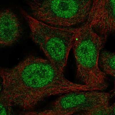 Immunocytochemistry/Immunofluorescence: PAAF1 Antibody [NBP2-55195] - Staining of human cell line SK-MEL-30 shows localization to nucleoplasm & cytosol.