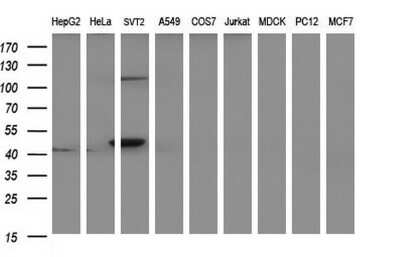 Western Blot: PAAF1 Antibody (OTI1F11) [NBP2-46309] - Analysis of extracts (35ug) from 9 different cell lines by using PAAF1 monoclonal antibody (HepG2: human; HeLa: human; SVT2: mouse; A549: human; COS7: monkey; Jurkat: human; MDCK: canine; PC12: rat; MCF7: human).