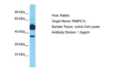 Western Blot: PABPC1L Antibody [NBP2-83353] - Host: Rabbit. Target Name: PABPC1L. Sample Tissue: Human Jurkat Whole Cell. Antibody Dilution: 1ug/ml