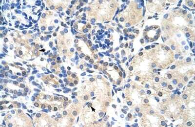 Immunohistochemistry-Paraffin: PABPC4 Antibody [NBP1-57448] - Human kidney Tissue, antibody concentration 4-8ug/ml. Cells with positive label: renal corpuscle cells (indicated with arrows) 400X magnification.