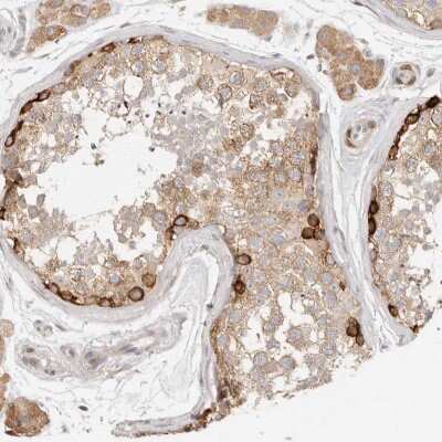 Immunohistochemistry-Paraffin PABPC4 Antibody - BSA Free