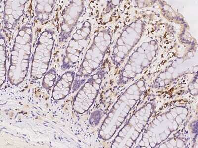 Immunohistochemistry-Paraffin: PABPC4 Antibody [NBP2-97931] - Staining of human PABPC4 in human rectum with rabbit polyclonal antibody at 1:2500 dilution.