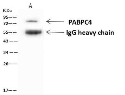 Immunoprecipitation: PABPC4 Antibody [NBP2-97931] - Lane A:0.5 mg U-251 MG Whole Cell Lysate1 uL anti-PABPC4 rabbit polyclonal antibody and 60 ug of Immunomagnetic beads Protein A/G.Primary antibody:Anti-PABPC4 rabbit polyclonal antibody,at 1:500 dilutionSecondary antibody:Goat Anti-Rabbit IgG (H+L)/HRP at 1/10000 dilutionDeveloped using the ECL technique.Performed under reducing conditions.Predicted band size: 71 kDaObserved band size :75 kDa