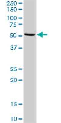 Western Blot: PABPC4 Antibody [H00008761-D01P] - PC4 MaxPab rabbit polyclonal antibody. Western Blot analysis of PABPC4 expression in mouse lung.