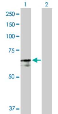 Western Blot: PABPC4 Antibody [H00008761-D01P] - Analysis of PABPC4 expression in transfected 293T cell line by PABPC4 polyclonal antibody.Lane 1: PABPC4 transfected lysate(72.40 KDa).Lane 2: Non-transfected lysate.