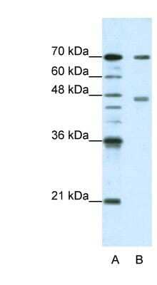 Western Blot: PABPC4 Antibody [NBP1-57448] - HepG2 cell lysate, Antibody Titration: 1.25ug/ml