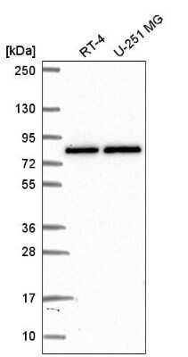 Western Blot: PABPC4 Antibody [NBP2-58575] - Analysis in human cell line RT-4 and human cell line U-251 MG.