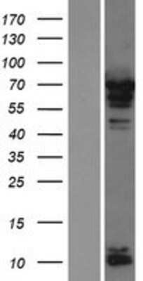 Western Blot: PABPC4 Overexpression Lysate (Adult Normal) [NBP2-07951] Left-Empty vector transfected control cell lysate (HEK293 cell lysate); Right -Over-expression Lysate for PABPC4.