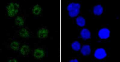 Immunocytochemistry/Immunofluorescence: PABPN1 Antibody (JM11-28) [NBP2-67015] - Staining PABPN1 in AGS cells (green). The nuclear counter stain is DAPI (blue). Cells were fixed in paraformaldehyde, permeabilised with 0.25% Triton X100/PBS.