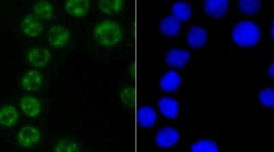 Immunocytochemistry/Immunofluorescence: PABPN1 Antibody (JM11-28) [NBP2-67015] - Staining PABPN1 in SW480 cells (green). The nuclear counter stain is DAPI (blue). Cells were fixed in paraformaldehyde, permeabilised with 0.25% Triton X100/PBS.