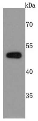 Western Blot: PABPN1 Antibody (JM11-28) [NBP2-67015] - Analysis of PABPN1 on MCF-7 cells lysates using anti-PABPN1 antibody at 1/500 dilution.
