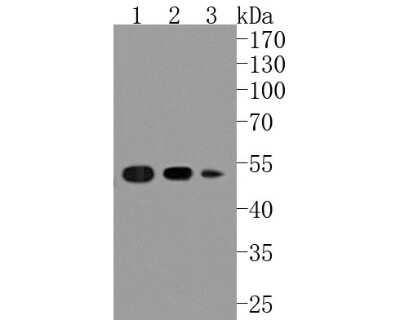 Western Blot: PABPN1 Antibody (JM11-28) [NBP2-67015] - Western blot analysis of PABPN1 on different lysates. Proteins were transferred to a PVDF membrane and blocked with 5% BSA in PBS for 1 hour at room temperature. The primary antibody (1/500) was used in 5% BSA at room temperature for 2 hours. Goat Anti-Rabbit IgG - HRP Secondary Antibody (HA1001) at 1:5,000 dilution was used for 1 hour at room temperature. Positive control: Lane 1: MCF-7 cell lysate Lane 2: SH-SY5Y cell lysate Lane 3: rat skin tissue lysate