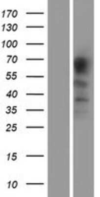 Western Blot: PACE4 Overexpression Lysate (Adult Normal) [NBP2-05676] Left-Empty vector transfected control cell lysate (HEK293 cell lysate); Right -Over-expression Lysate for PACE4.