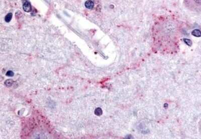 Immunohistochemistry-Paraffin: PACE4/PCSK6 Antibody [NB110-39050] - Staining of human brain, cortex. Immunohistochemistry of formalin-fixed, paraffin-embedded tissue after heat-induced antigen retrieval. Antibody concentration 20 ug/ml.