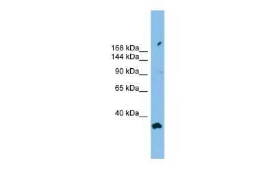 Western Blot: PACS2 Antibody [NBP2-85435] - WB Suggested Anti-PACS2 Antibody Titration: 0.2-1 ug/ml. ELISA Titer: 1:312500. Positive Control: A549 cell lysate