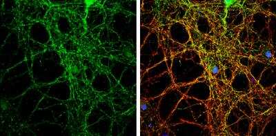 Immunocytochemistry/Immunofluorescence: PACSIN1 Antibody [NBP1-32324] - PACSIN1 antibody detects PACSIN1 protein by immunofluorescent analysis.Sample: DIV14 rat E18 primary cortical neurons were fixed in 4% paraformaldehyde at RT for 15 min. Green: PACSIN1 protein stained by PACSIN1 antibody diluted at 1:500. Red: beta Tubulin 3/ Tuj1, stained by beta Tubulin 3/ Tuj1 antibody diluted at 1:500. Blue: Fluoroshield with DAPI.