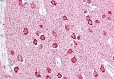 Immunohistochemistry-Paraffin: PACSIN1 Antibody [NB100-861] - Staining of paraffin embedded Human Cortex. Steamed antigen retrieval with citrate buffer pH 6, AP-staining.