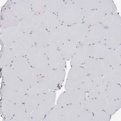 Immunohistochemistry-Paraffin: PACSIN1 Antibody [NBP1-87067] - Staining of human skeletal muscle shows low expression as expected.