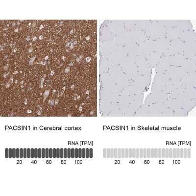 Immunohistochemistry-Paraffin: PACSIN1 Antibody [NBP1-87067] - Staining in human cerebral cortex and skeletal muscle tissues using anti-PACSIN1 antibody. Corresponding PACSIN1 RNA-seq data are presented for the same tissues.
