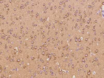 Immunohistochemistry-Paraffin: PACSIN1 Antibody [NBP2-99230] - Immunochemical staining PACSIN1 in human brain with rabbit polyclonal antibody at 1:300 dilution, formalin-fixed paraffin embedded sections.