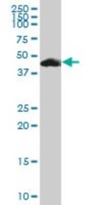 Western Blot: PACSIN1 Antibody [H00029993-B01P] - Analysis of PACSIN1 expression in rat brain.