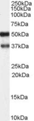 Western Blot: PACSIN1 Antibody [NB100-861] - Staining of hippocampus lysate (35 ug protein in RIPA buffer). Primary incubation was 1 hour. Detected by chemiluminescence.